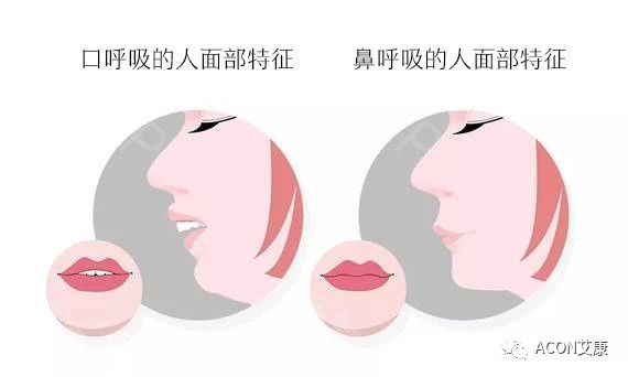 過敏性鼻炎會讓孩子變傻？！家長該如何應(yīng)對